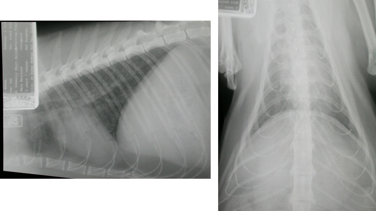 concave edge to chest on lateral sides on DV view
